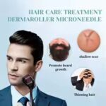 ⁦ديرما رولر بإبر دقيقة .50 مم لتحفيز الكولاجين وتجديد البشرة وعلاج آثار الندبات⁩ - الصورة ⁦3⁩